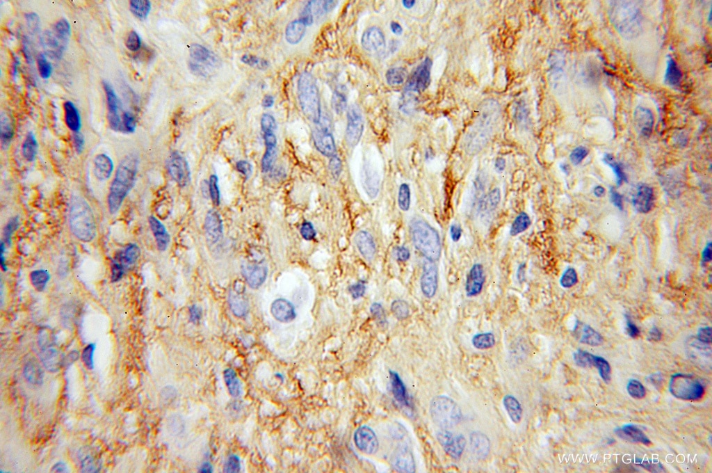 GNAO1 Polyclonal antibody