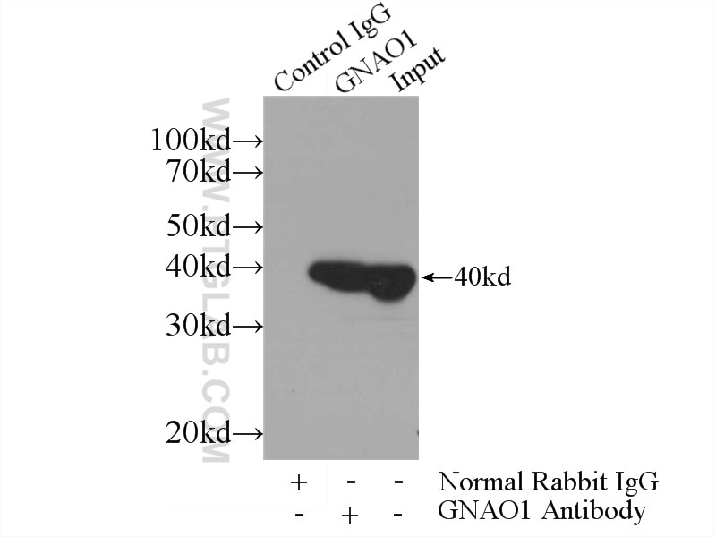 IP experiment of mouse brain using 12635-1-AP