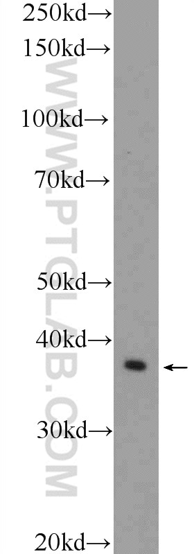 Western Blot (WB) analysis of Y79 cells using GNAO1 Polyclonal antibody (12635-1-AP)