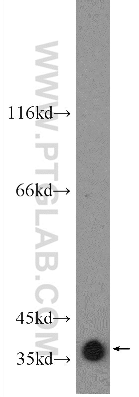 GNAO1 Polyclonal antibody