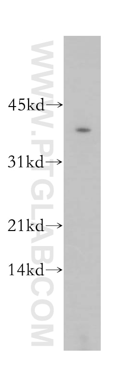 Western Blot (WB) analysis of human liver tissue using GNAO1 Polyclonal antibody (12635-1-AP)