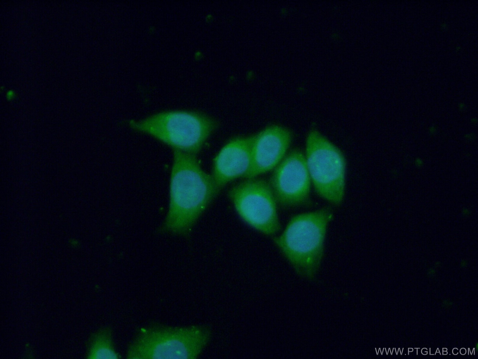 Immunofluorescence (IF) / fluorescent staining of HeLa cells using GNAQ Polyclonal antibody (13927-1-AP)