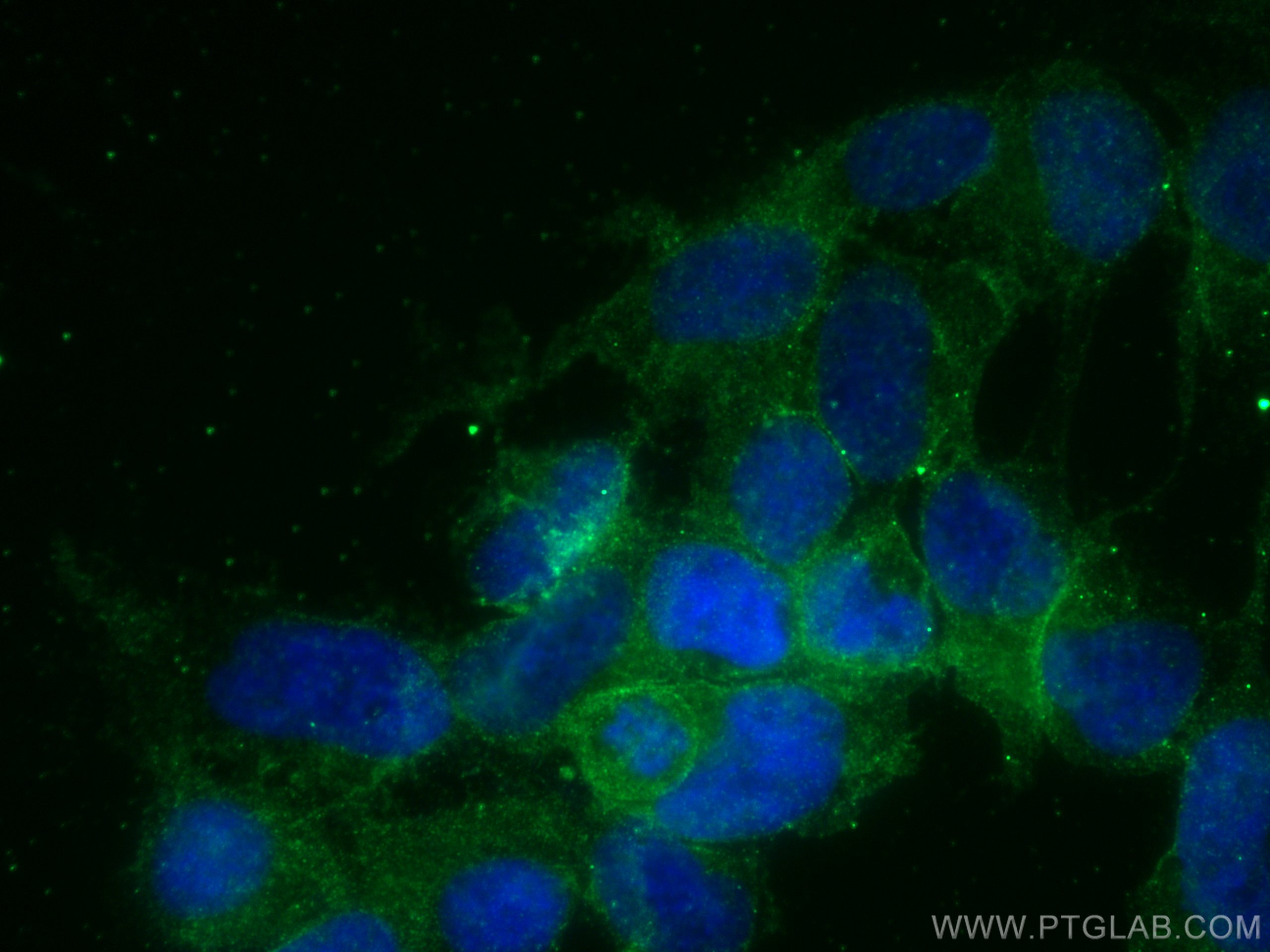 Immunofluorescence (IF) / fluorescent staining of HEK-293 cells using GNAQ Polyclonal antibody (13927-1-AP)