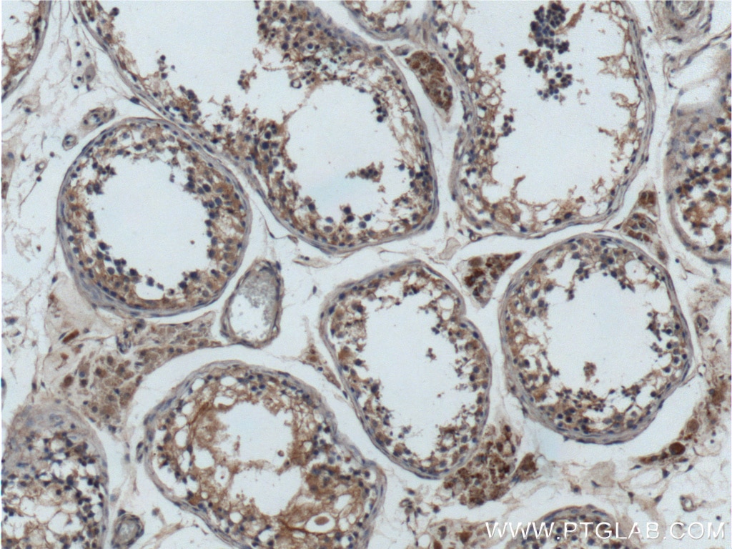 Immunohistochemistry (IHC) staining of human testis tissue using GNAQ Polyclonal antibody (13927-1-AP)