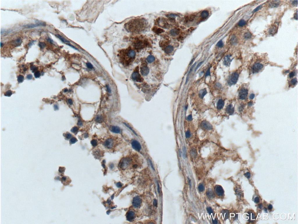 Immunohistochemistry (IHC) staining of human testis tissue using GNAQ Polyclonal antibody (13927-1-AP)