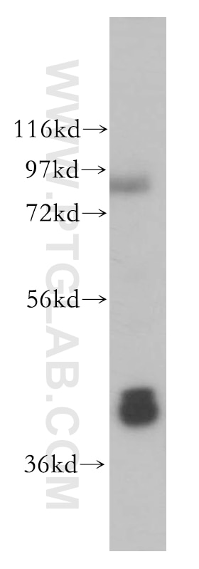 Western Blot (WB) analysis of mouse lung tissue using GNAQ Polyclonal antibody (13927-1-AP)