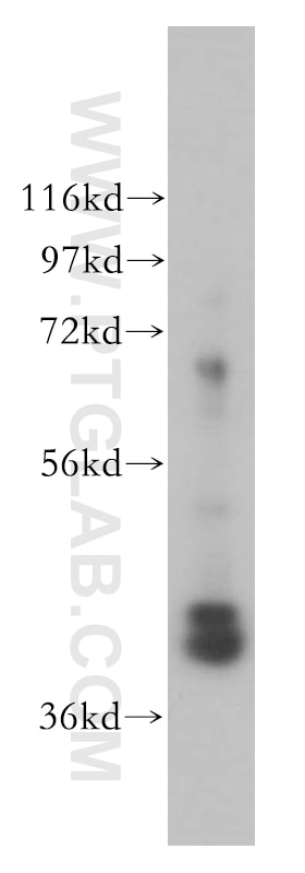 Western Blot (WB) analysis of mouse skin tissue using GNAQ Polyclonal antibody (13927-1-AP)