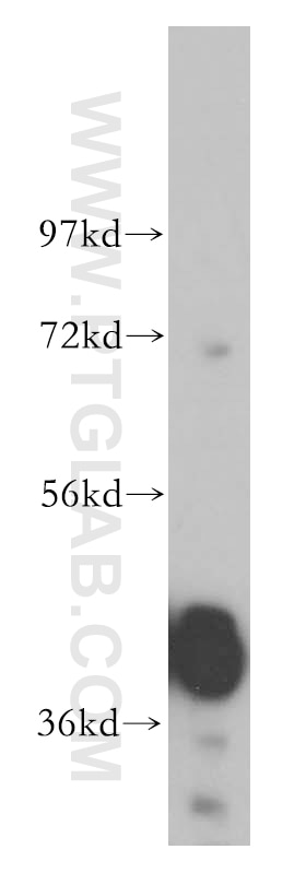 Western Blot (WB) analysis of human brain tissue using GNAQ Polyclonal antibody (13927-1-AP)