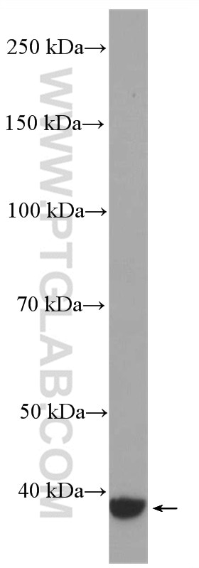 Western Blot (WB) analysis of PC-12 cells using GNAQ Polyclonal antibody (27264-1-AP)