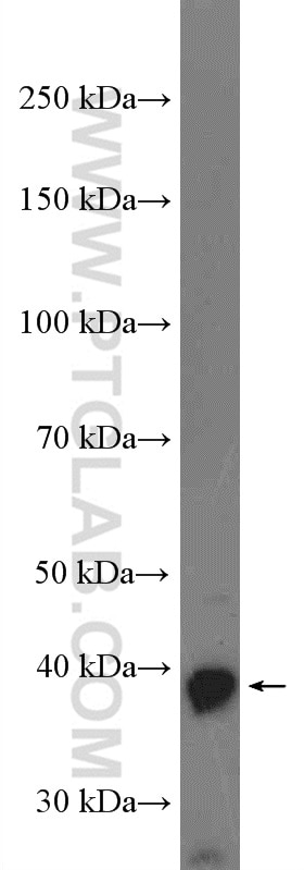 WB analysis of mouse brain using 27264-1-AP