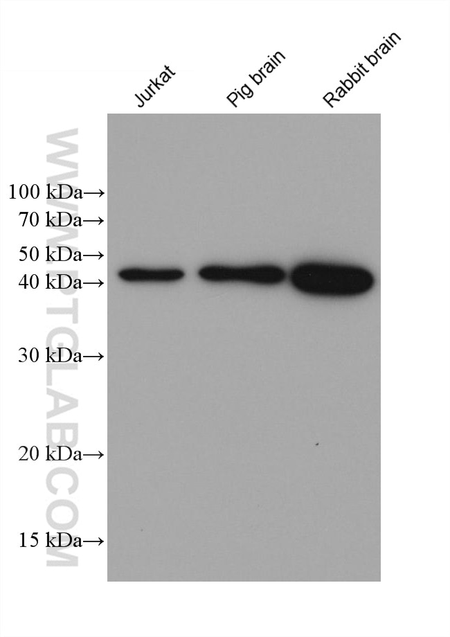 Western Blot (WB) analysis of various lysates using GNAQ Monoclonal antibody (68191-1-Ig)