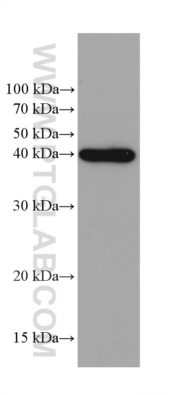 Western Blot (WB) analysis of pig cerebellum tissue using GNAQ Monoclonal antibody (68191-1-Ig)