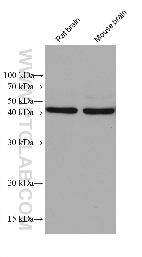 Western Blot (WB) analysis of various lysates using GNAQ Monoclonal antibody (68191-1-Ig)