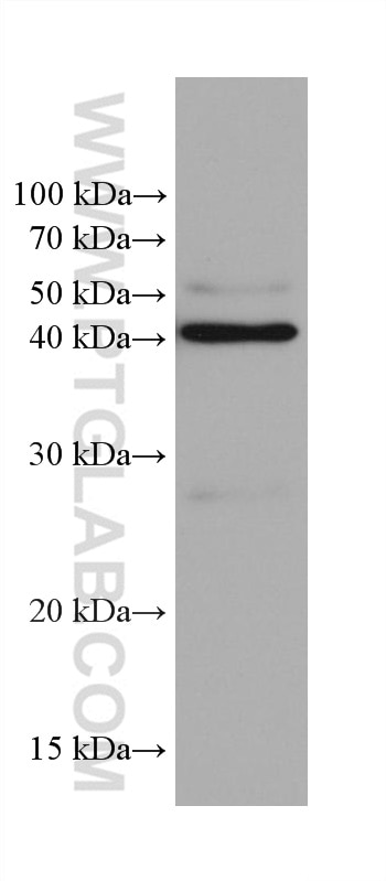 Western Blot (WB) analysis of rat cerebellum tissue using GNAQ Monoclonal antibody (68191-1-Ig)