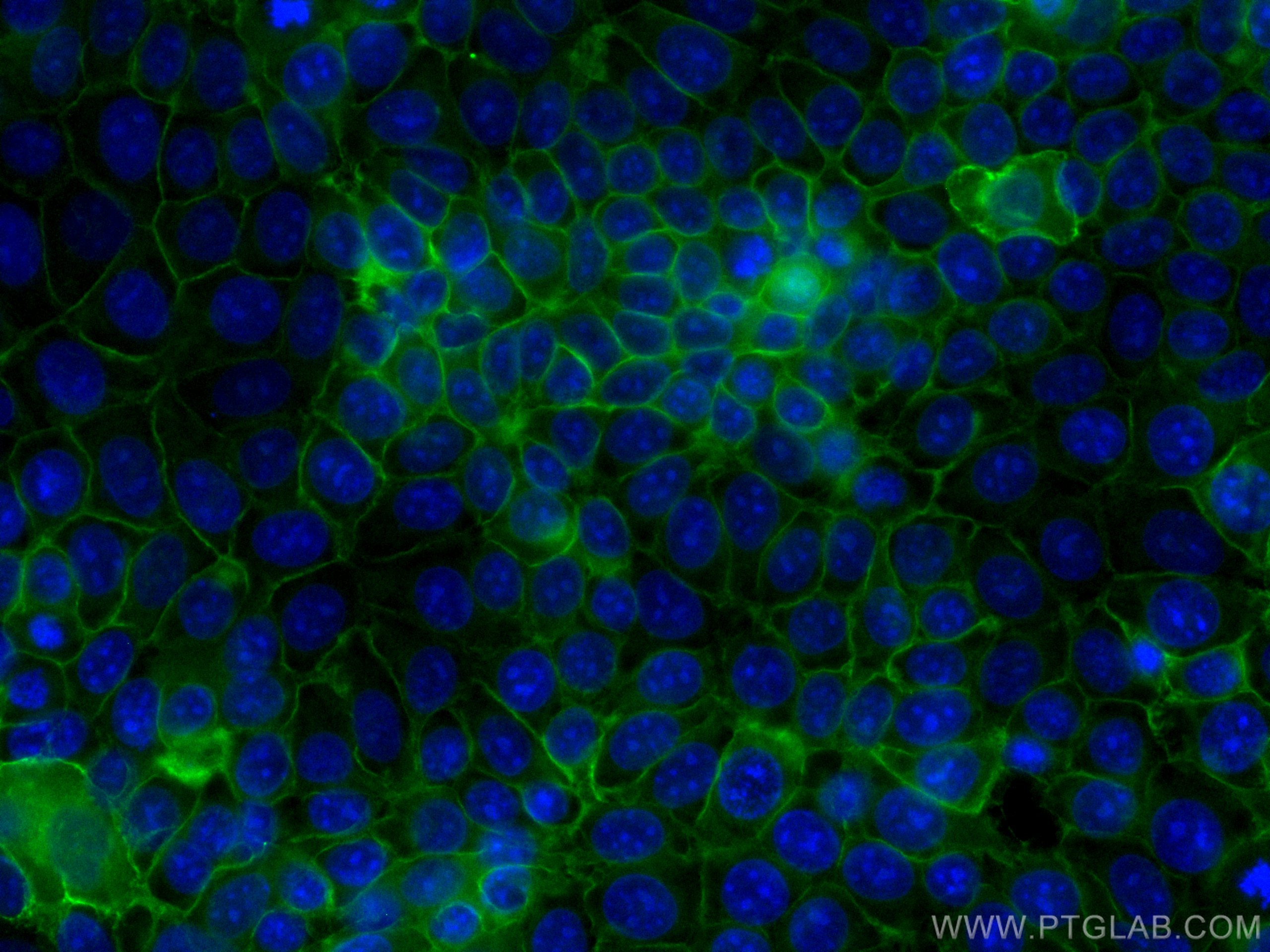 Immunofluorescence (IF) / fluorescent staining of MCF-7 cells using CoraLite® Plus 488-conjugated GNAS Monoclonal anti (CL488-66253)