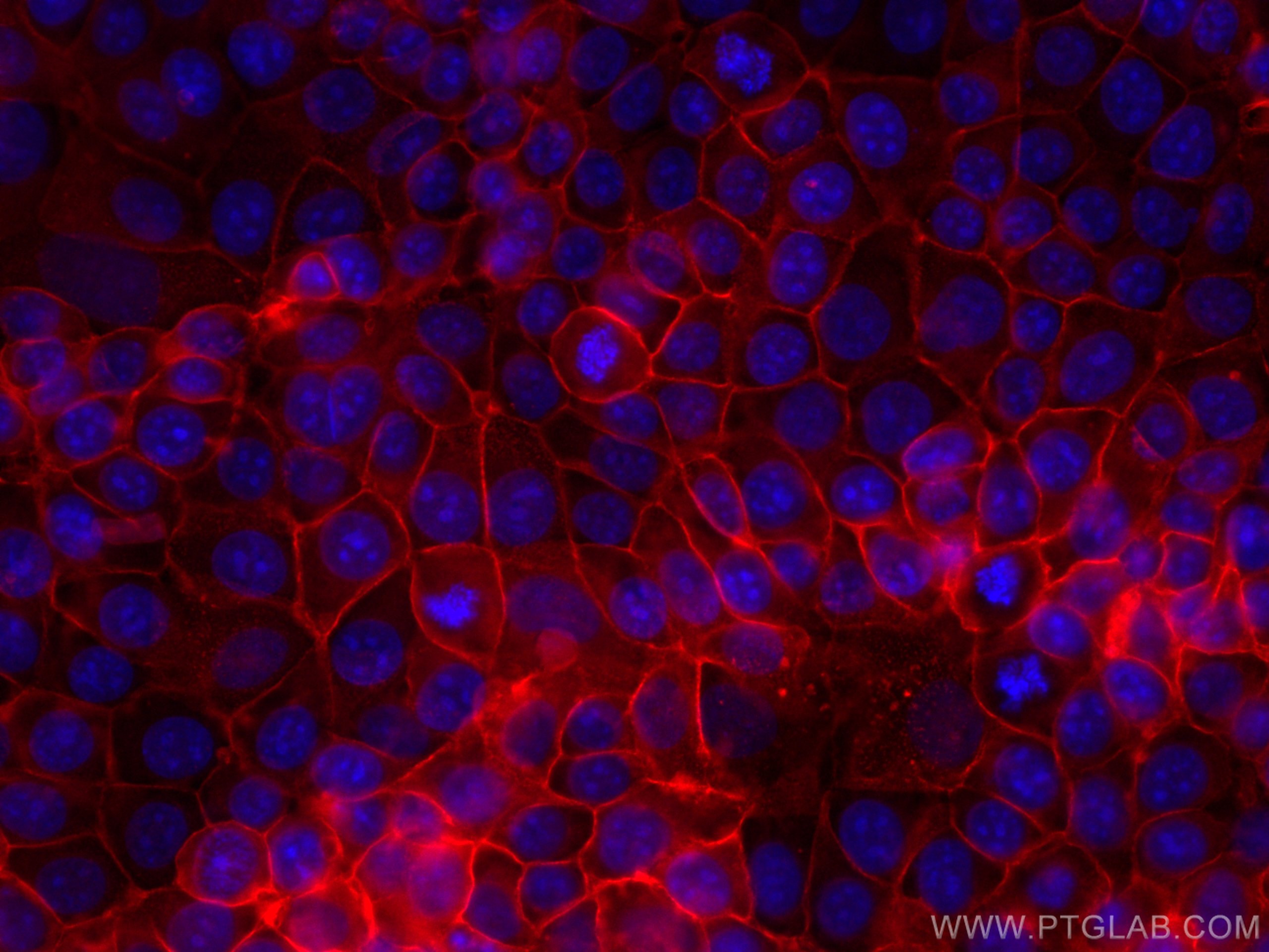 Immunofluorescence (IF) / fluorescent staining of MCF-7 cells using CoraLite®594-conjugated GNAS Monoclonal antibody (CL594-66253)