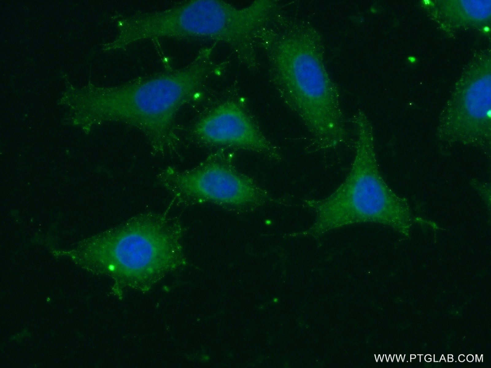 Immunofluorescence (IF) / fluorescent staining of HeLa cells using GNAT1 Polyclonal antibody (55167-1-AP)