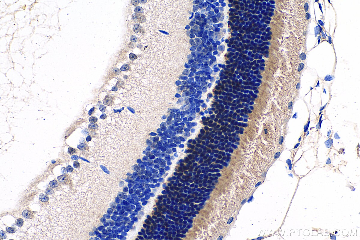 IHC staining of mouse eye using 55167-1-AP