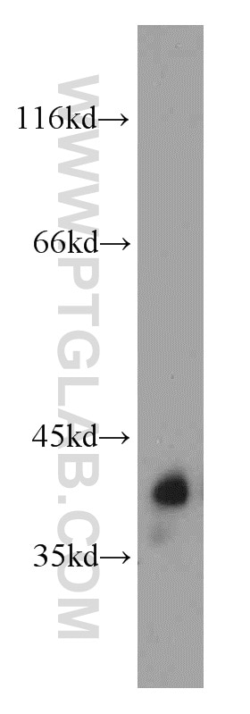 Western Blot (WB) analysis of mouse eye tissue using GNAT1 Polyclonal antibody (55167-1-AP)