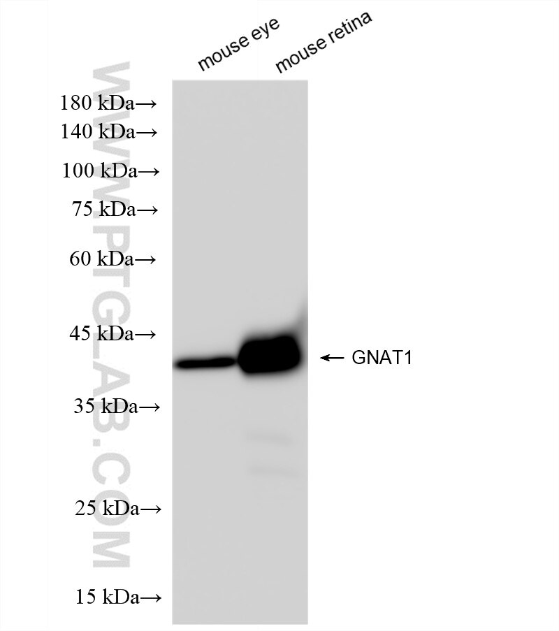 Western Blot (WB) analysis of various lysates using GNAT1 Recombinant antibody (85362-1-RR)