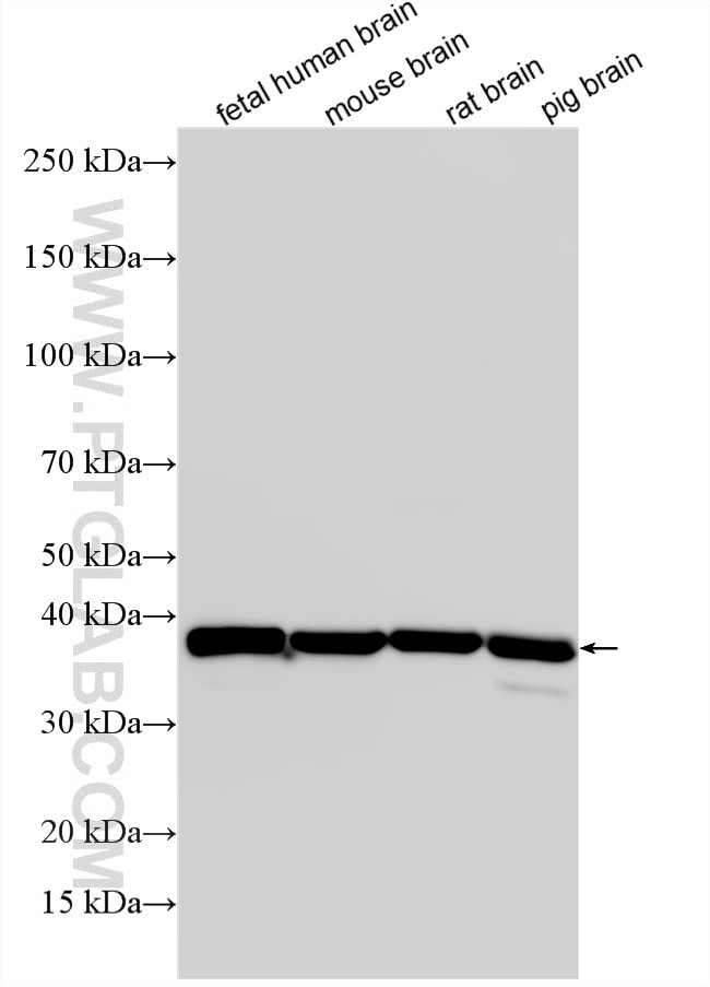 Western Blot (WB) analysis of various lysates using GNAZ Polyclonal antibody (12758-1-AP)