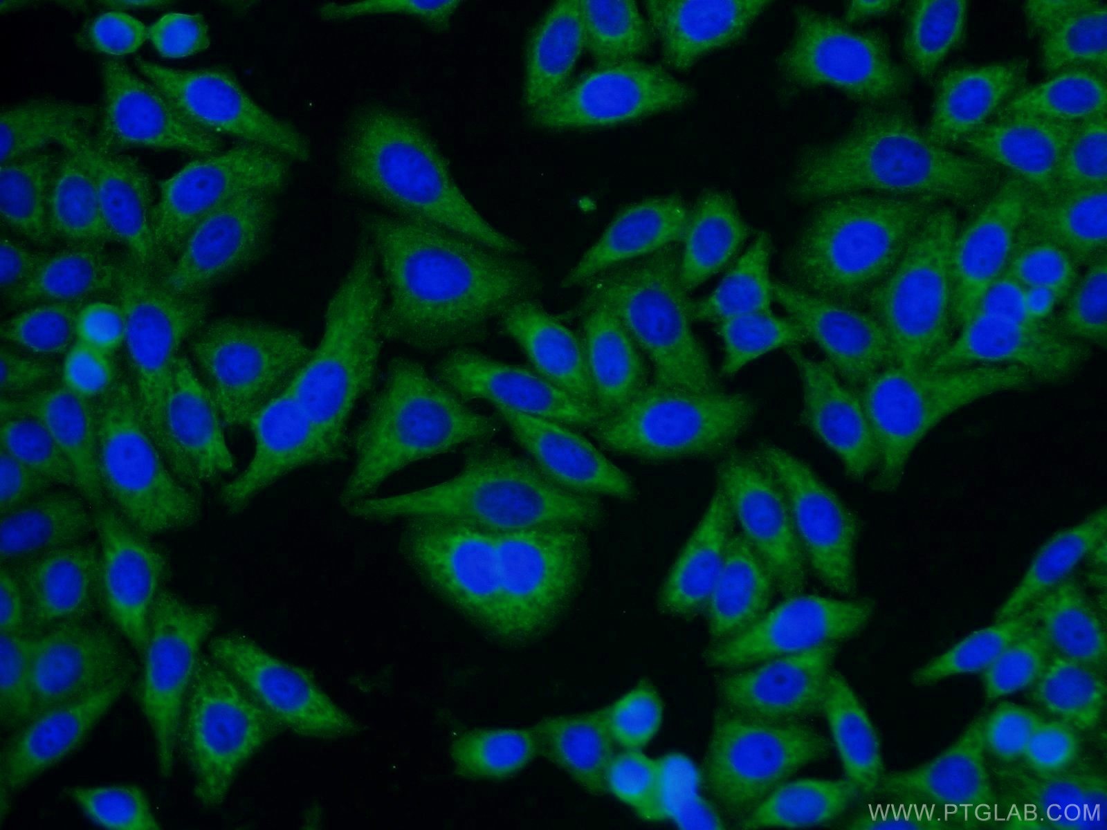 Immunofluorescence (IF) / fluorescent staining of HepG2 cells using GNB1 Polyclonal antibody (10247-2-AP)