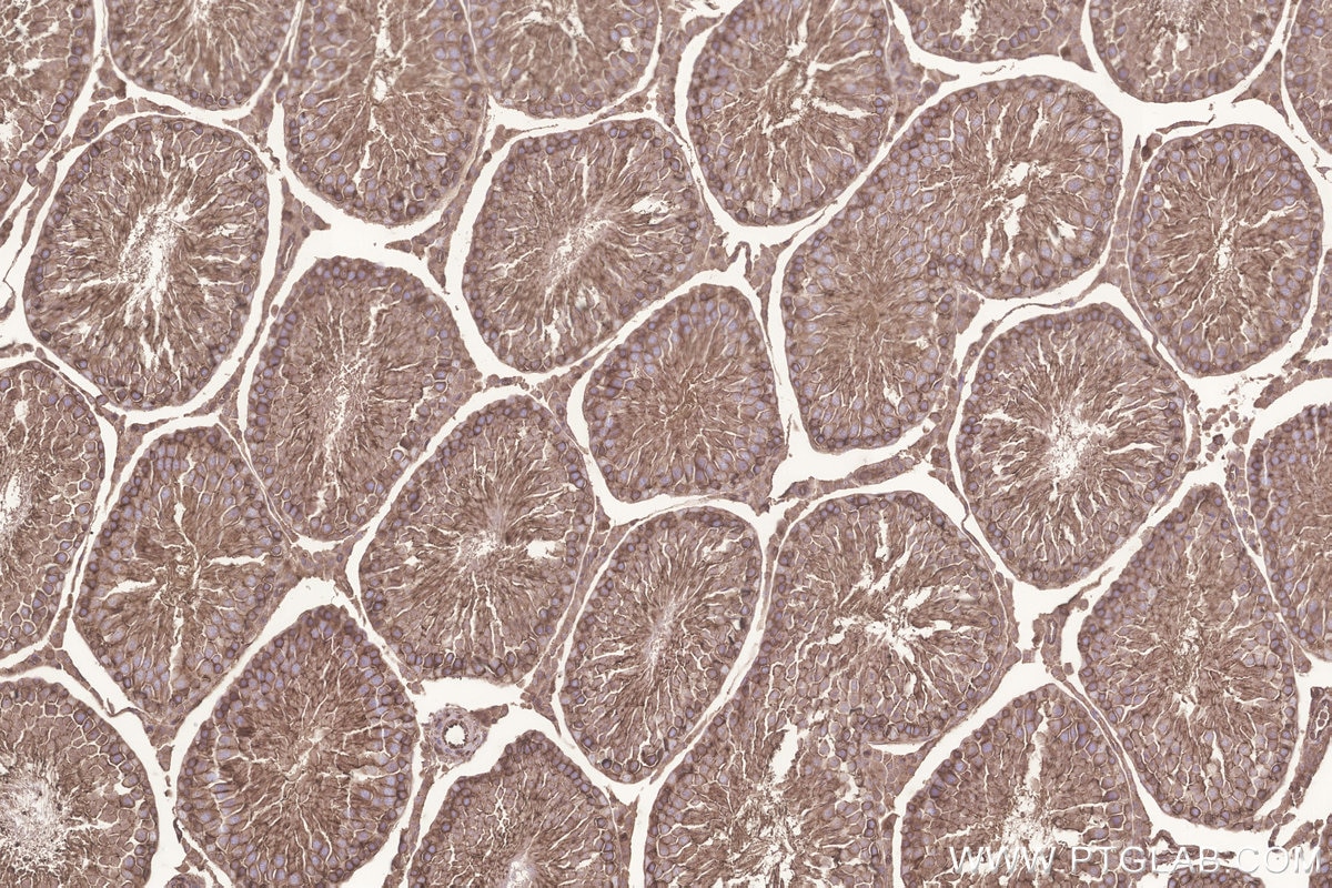 Immunohistochemistry (IHC) staining of rat testis tissue using GNB1 Polyclonal antibody (10247-2-AP)