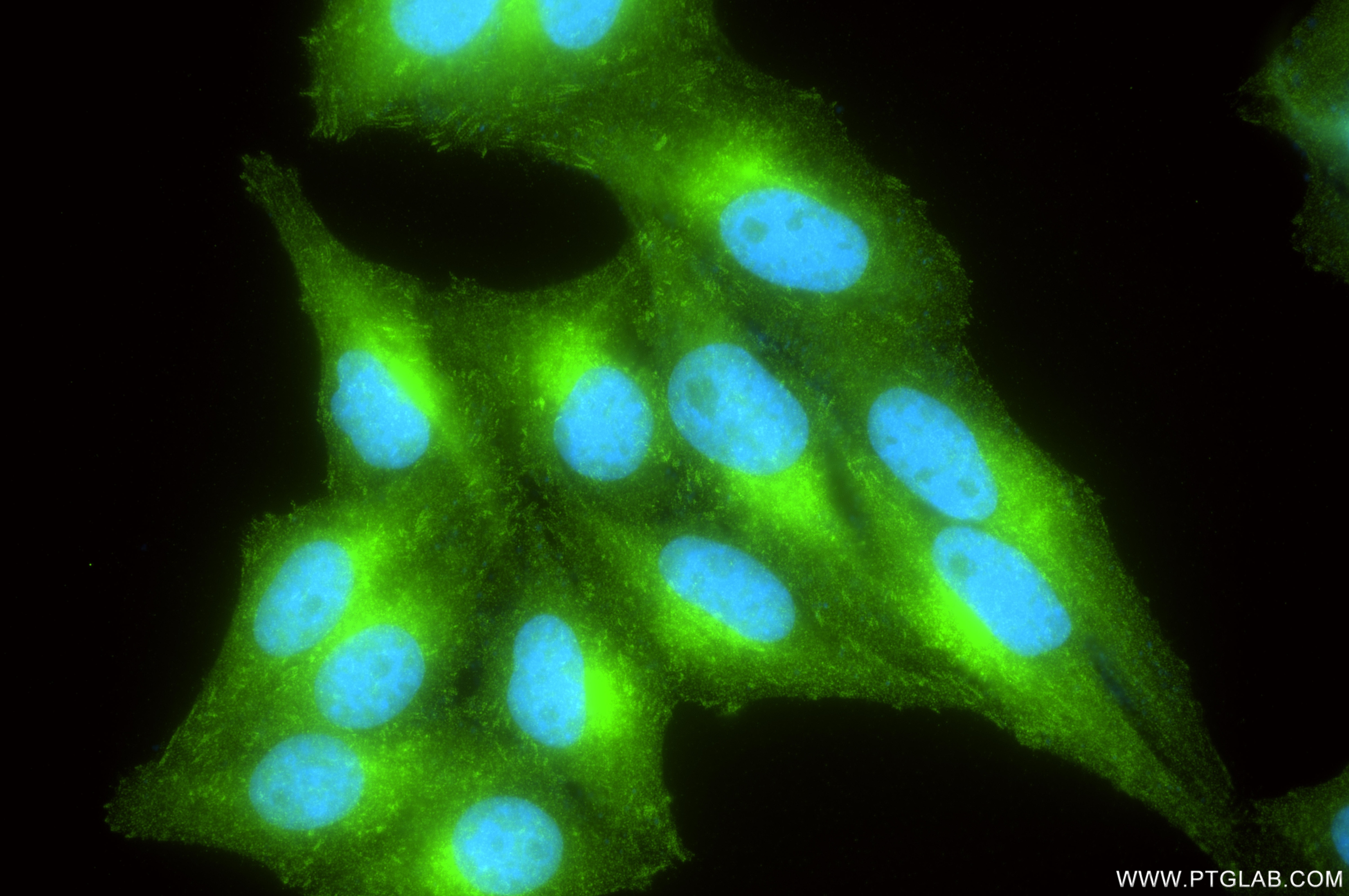 Immunofluorescence (IF) / fluorescent staining of HepG2 cells using GNB1 Recombinant monoclonal antibody (87127-3-RR)
