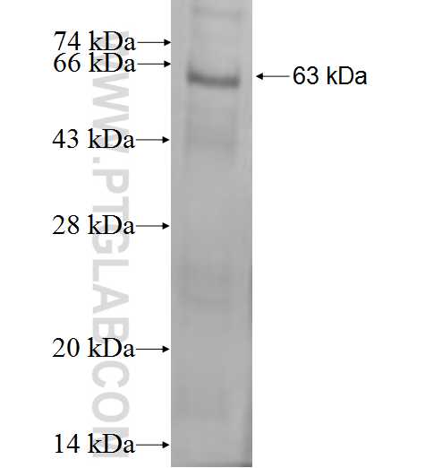 GNB1 fusion protein Ag0313 SDS-PAGE