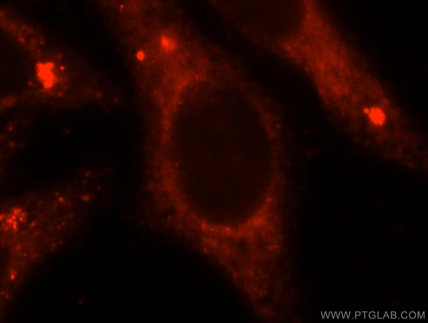 Immunofluorescence (IF) / fluorescent staining of HepG2 cells using GNB2 Polyclonal antibody (16090-1-AP)