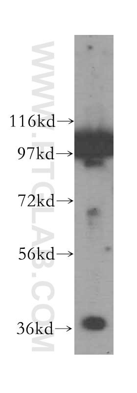 Western Blot (WB) analysis of Jurkat cells using GNB2 Polyclonal antibody (16090-1-AP)