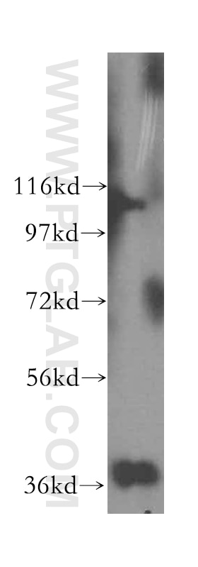 Western Blot (WB) analysis of HeLa cells using GNB2 Polyclonal antibody (16090-1-AP)
