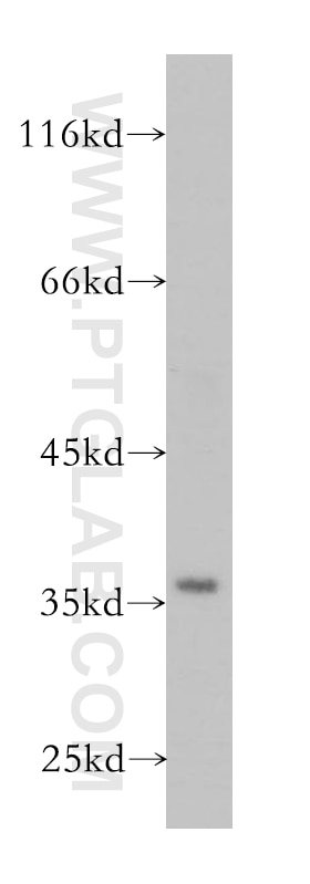 Western Blot (WB) analysis of HeLa cells using GNB2 Polyclonal antibody (16090-1-AP)