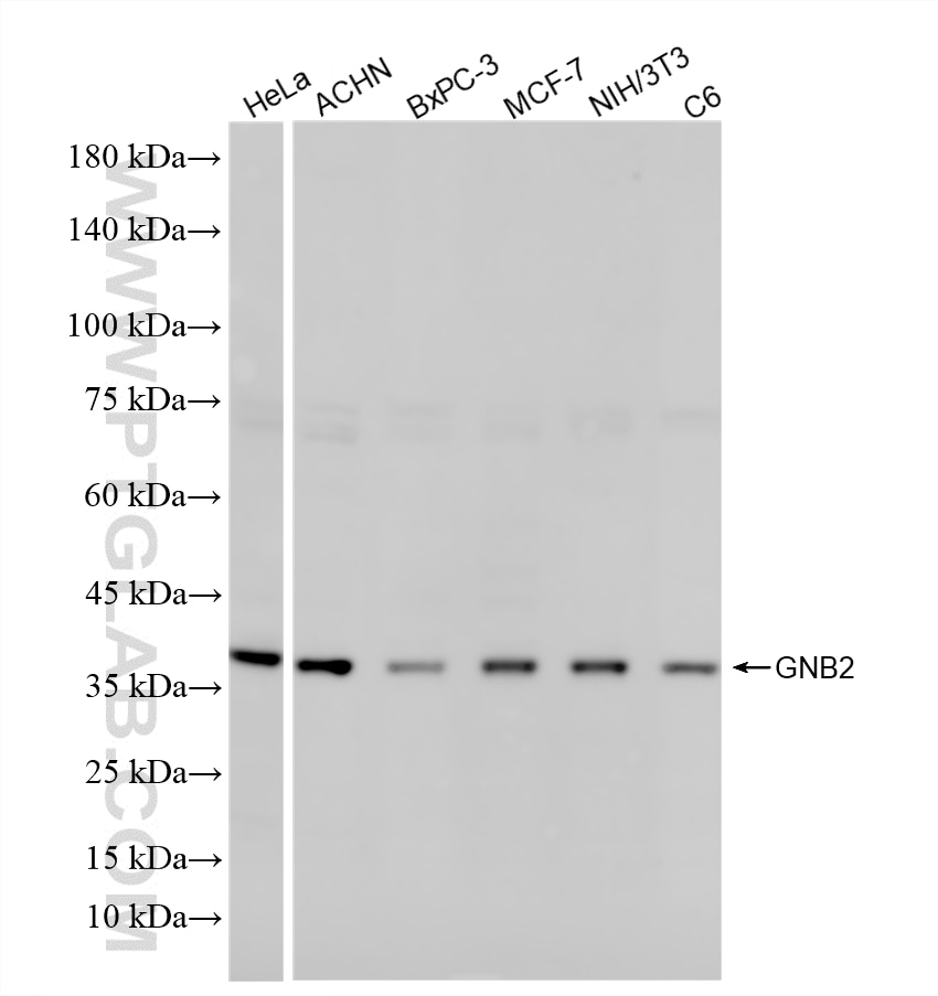 Western Blot (WB) analysis of various lysates using GNB2 Recombinant antibody (86469-1-RR)