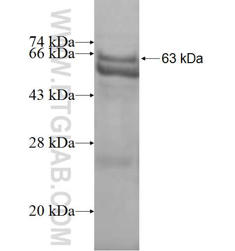 GNB2 fusion protein Ag9125 SDS-PAGE