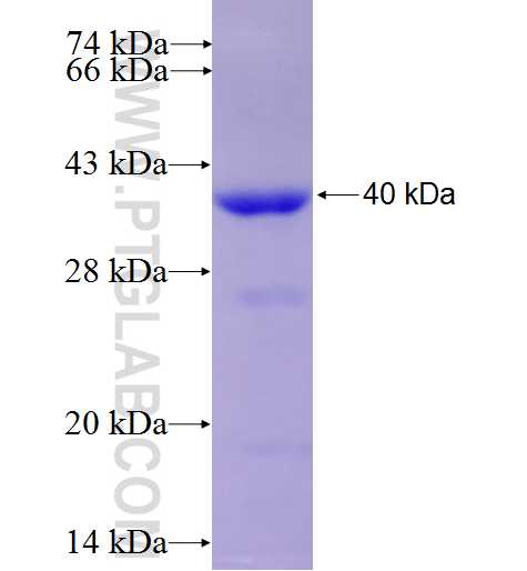GNB2 fusion protein Ag9260 SDS-PAGE