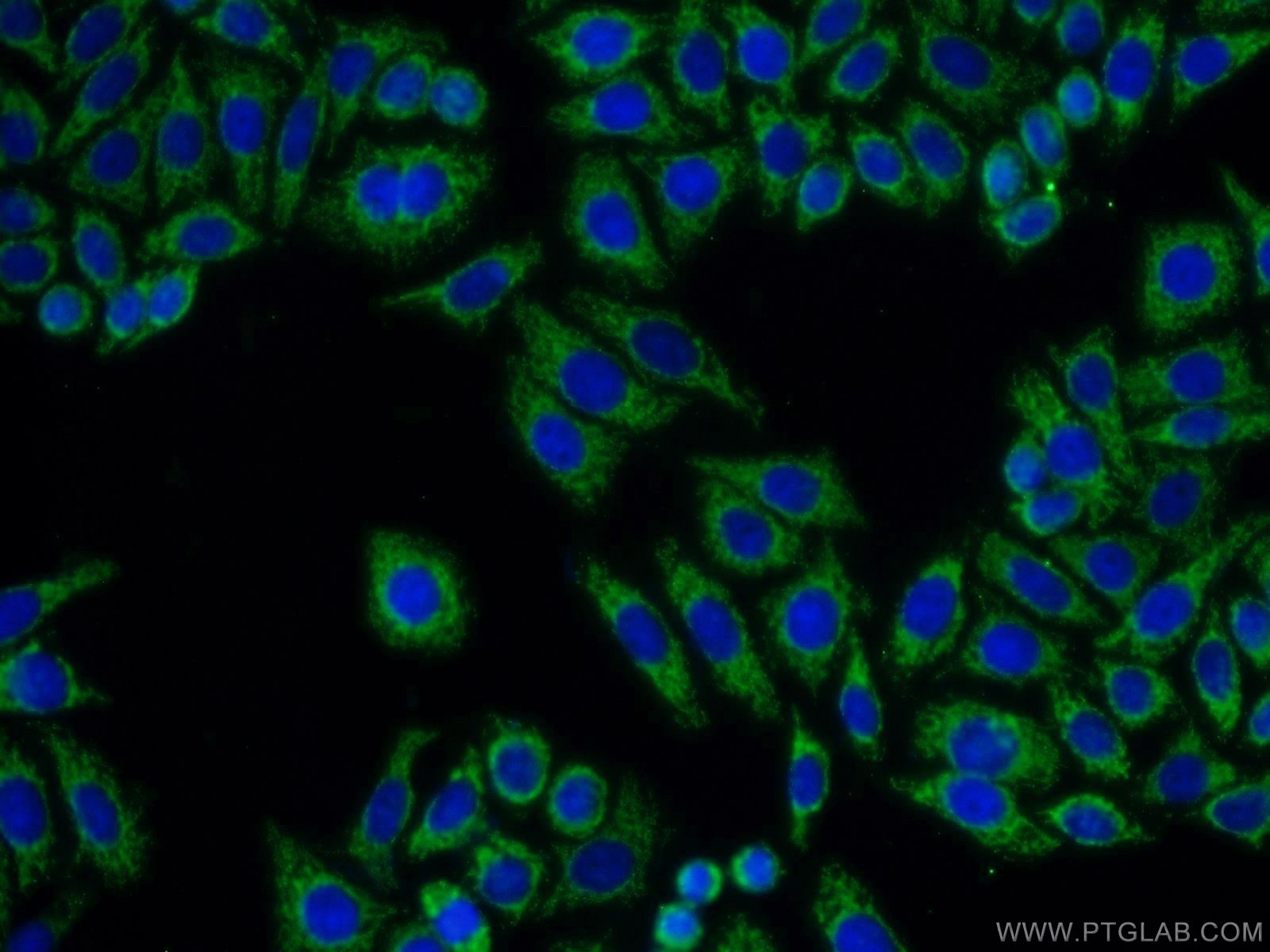 Immunofluorescence (IF) / fluorescent staining of HepG2 cells using GNB3 Polyclonal antibody (10081-1-AP)