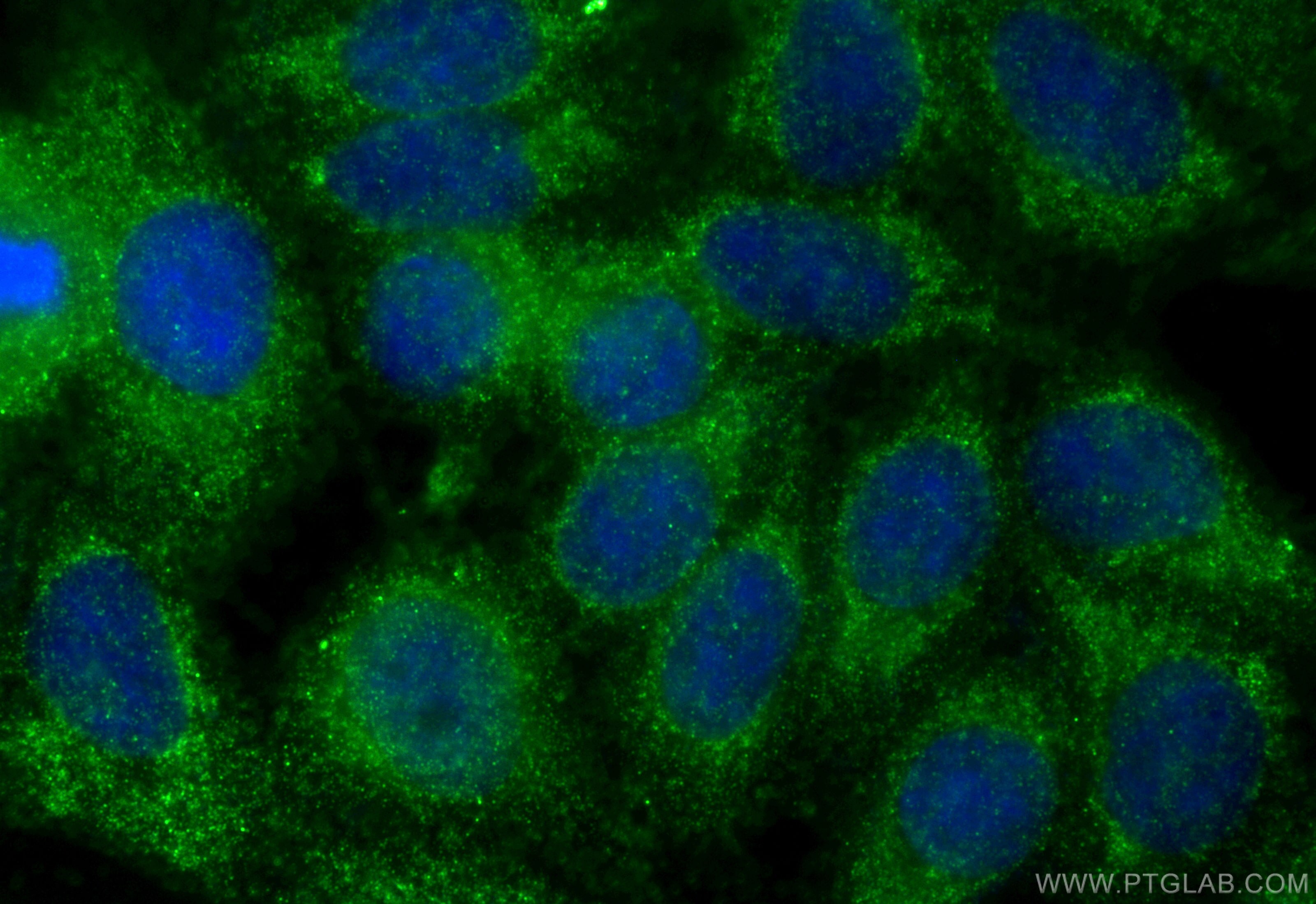 Immunofluorescence (IF) / fluorescent staining of HepG2 cells using GNB3 Polyclonal antibody (10081-1-AP)