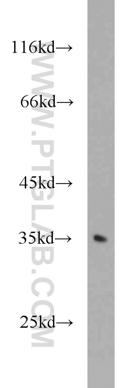 Western Blot (WB) analysis of mouse brain tissue using GNB3 Polyclonal antibody (10081-1-AP)