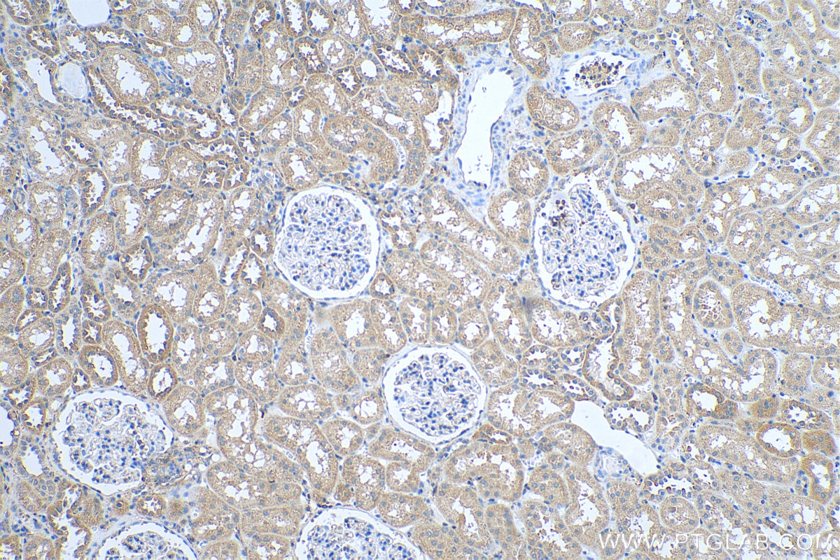 IHC staining of human kidney using 15388-1-AP