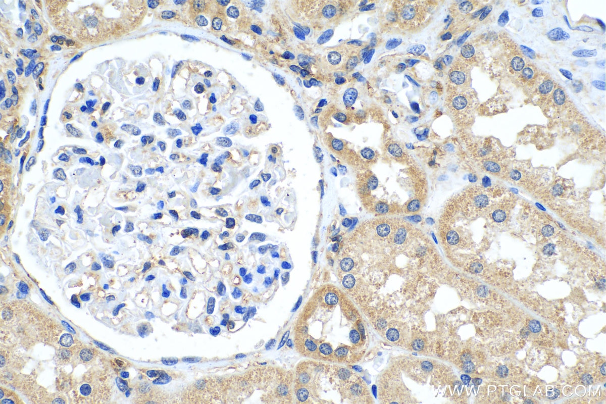 Immunohistochemistry (IHC) staining of human kidney tissue using GNB3 Polyclonal antibody (15388-1-AP)