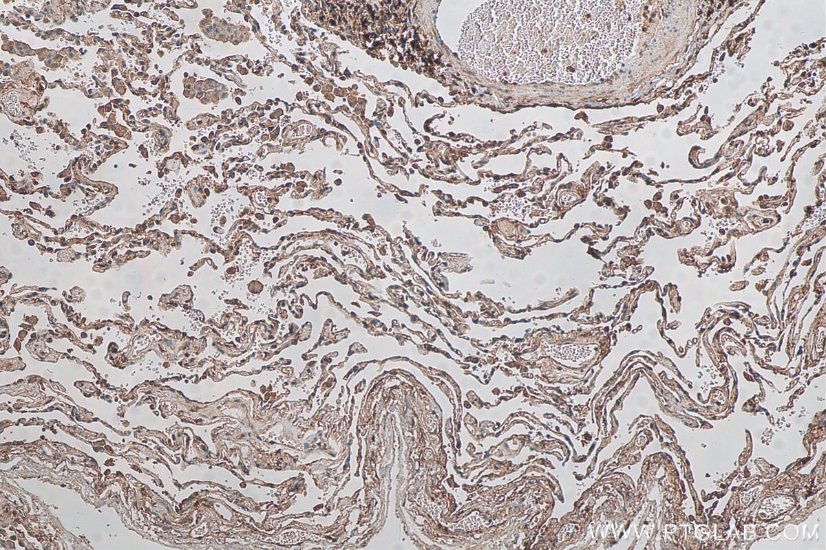 Immunohistochemistry (IHC) staining of human lung tissue using GNB3 Polyclonal antibody (15388-1-AP)