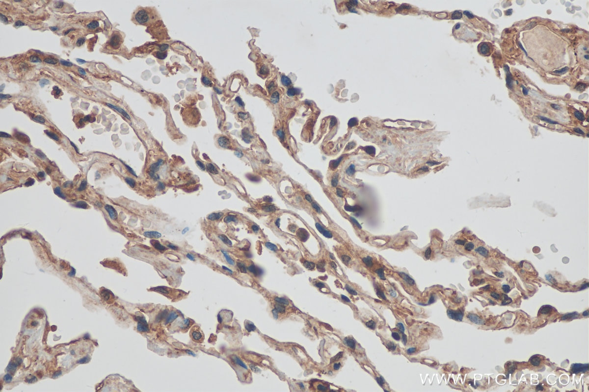 Immunohistochemistry (IHC) staining of human lung tissue using GNB3 Polyclonal antibody (15388-1-AP)