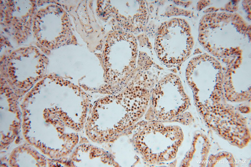 Immunohistochemistry (IHC) staining of human testis tissue using GNB3 Polyclonal antibody (15388-1-AP)