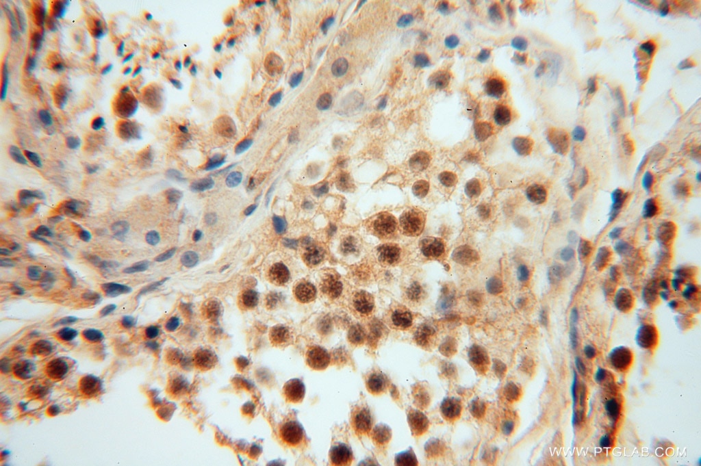 Immunohistochemistry (IHC) staining of human testis tissue using GNB3 Polyclonal antibody (15388-1-AP)