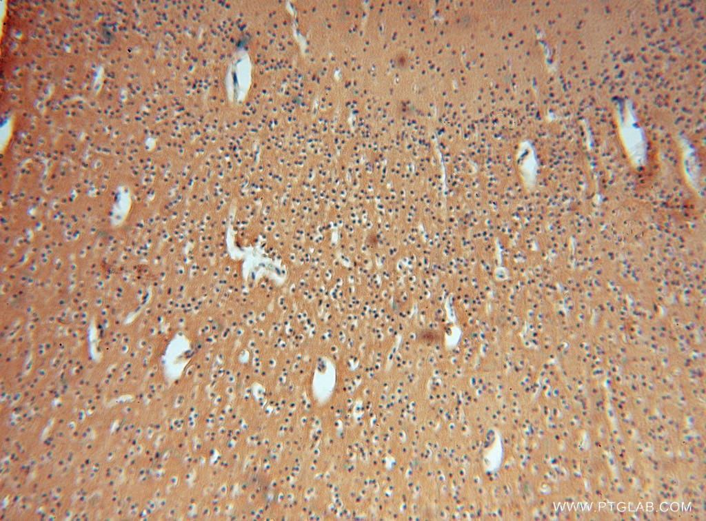 Immunohistochemistry (IHC) staining of human brain tissue using GNB3 Polyclonal antibody (15388-1-AP)