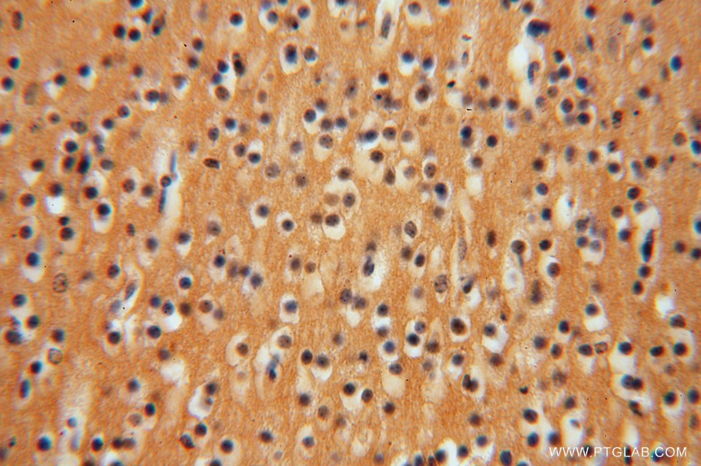 Immunohistochemistry (IHC) staining of human brain tissue using GNB3 Polyclonal antibody (15388-1-AP)