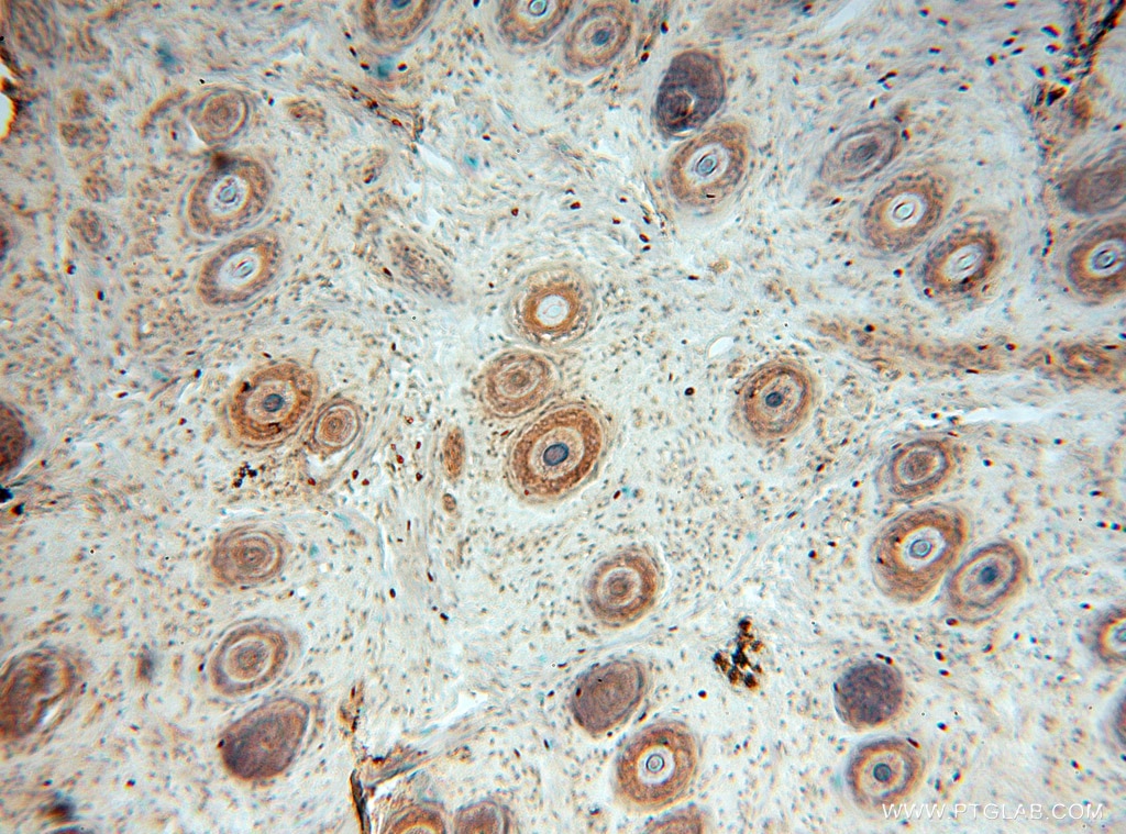 IHC staining of human ovary using 15388-1-AP