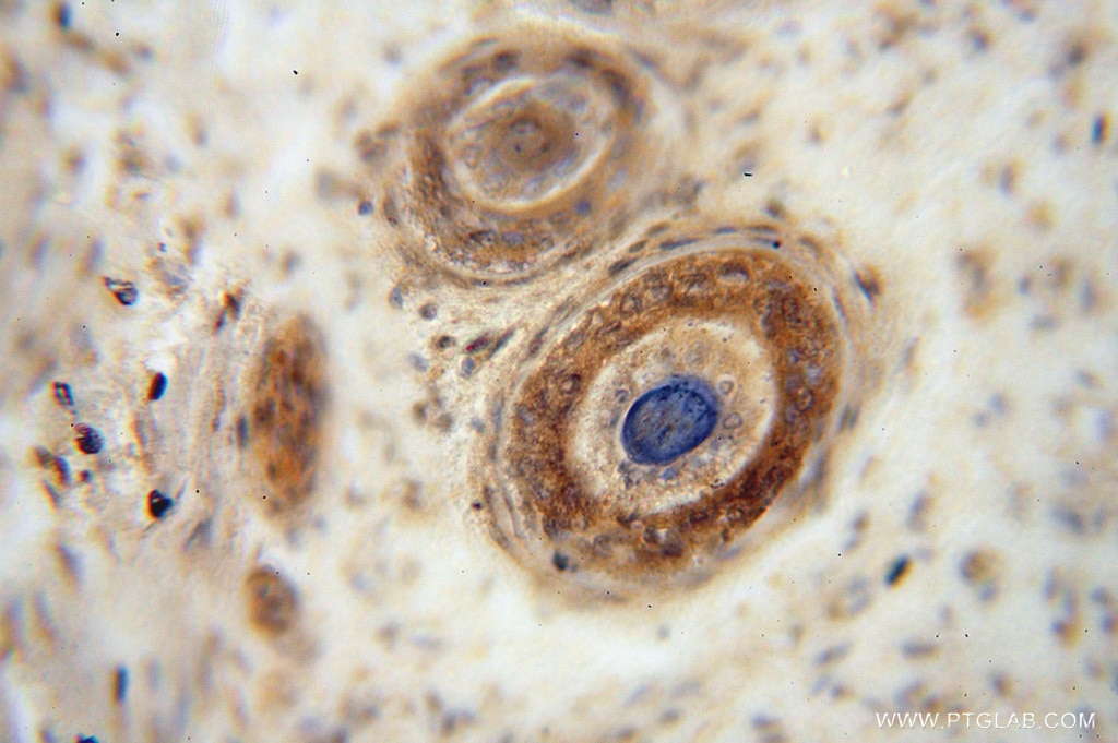 Immunohistochemistry (IHC) staining of human ovary tissue using GNB3 Polyclonal antibody (15388-1-AP)