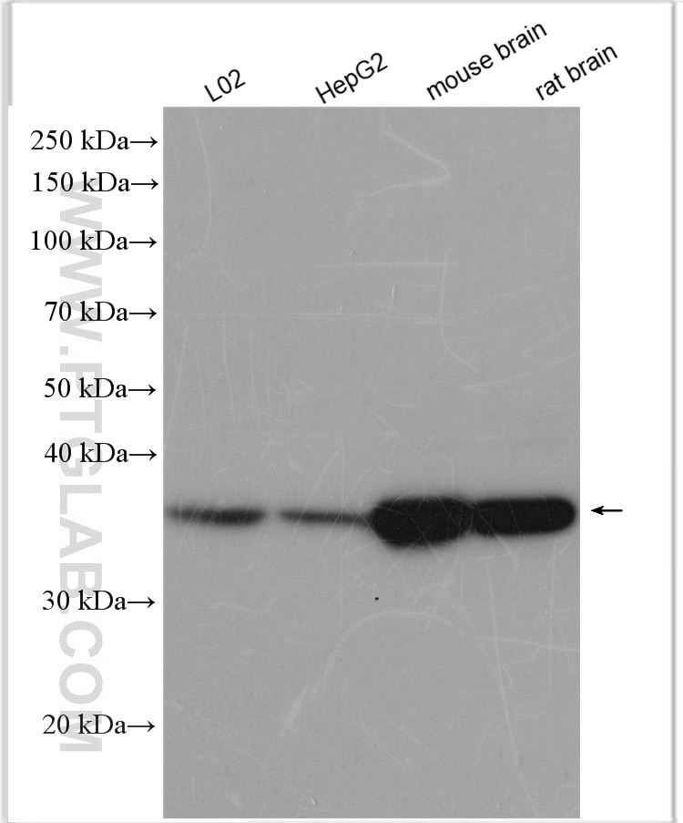 Western Blot (WB) analysis of various lysates using GNB3 Polyclonal antibody (15388-1-AP)